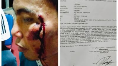 Gara-Gara Menegur, Warga Tiyuh Panaragan Diduga Jadi Korban Penganiayaan di Pulung Kencana